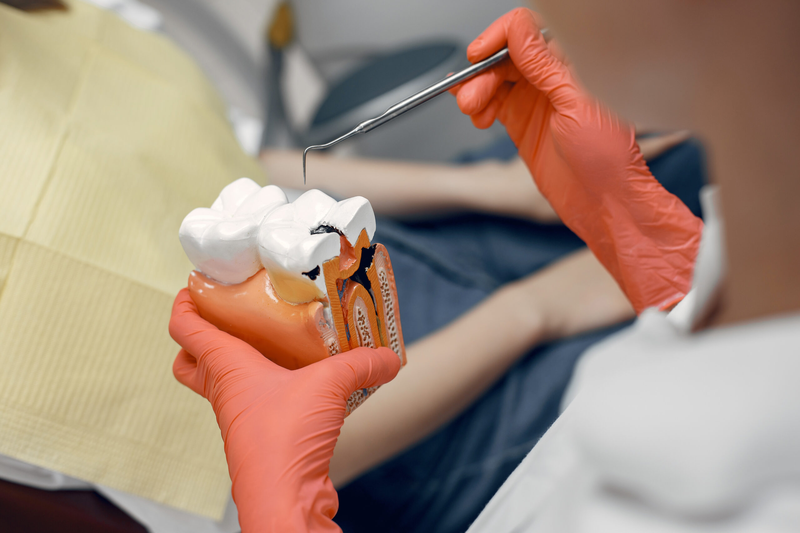 Root Canal Treatment in Rayasandra